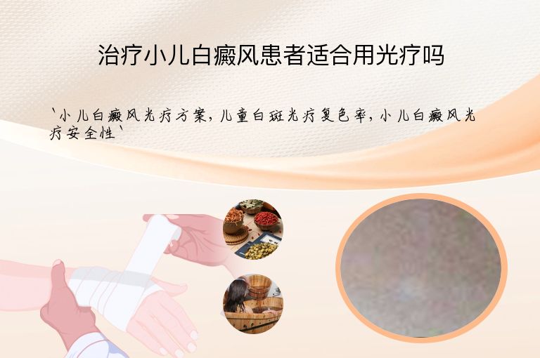 治疗小儿白癜风患者适合用光疗吗