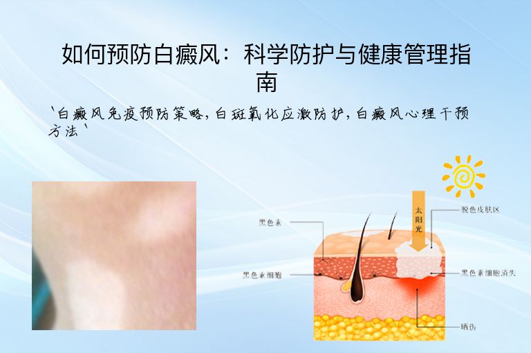 如何预防白癜风:科学防护与健康管理指南