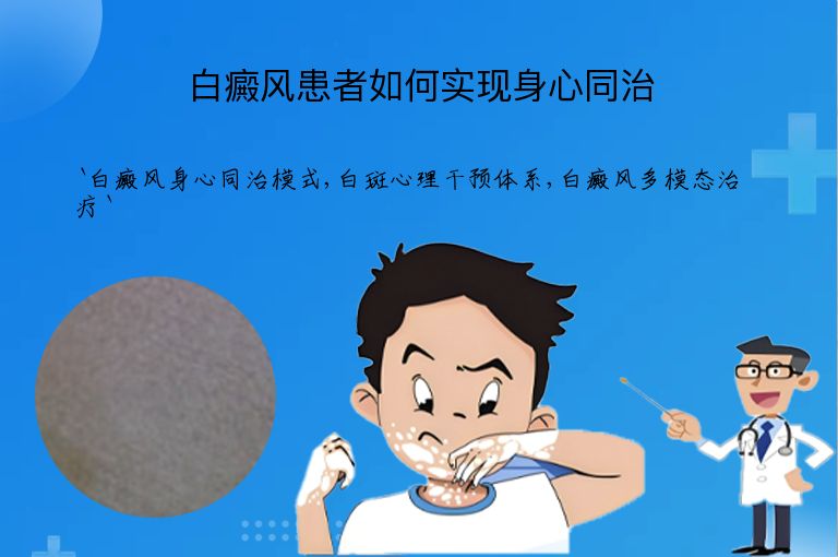 白癜风患者如何实现身心同治”