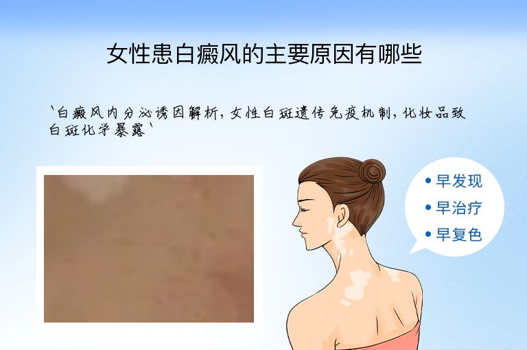 https://www.bdfsjzyy.com/d/file/p/482f1dbf4459c80dbc08eeef1ef91611.jpeg