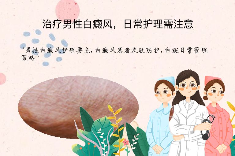 治疗男性白癜风,日常护理需注意