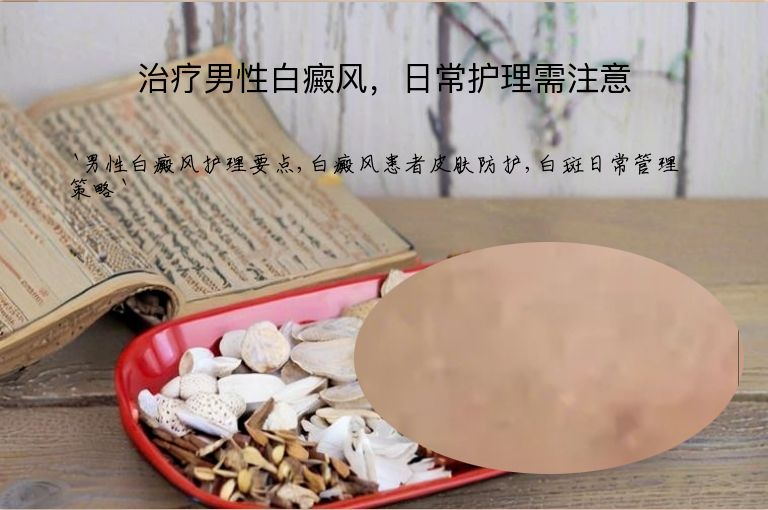 治疗男性白癜风,日常护理需注意