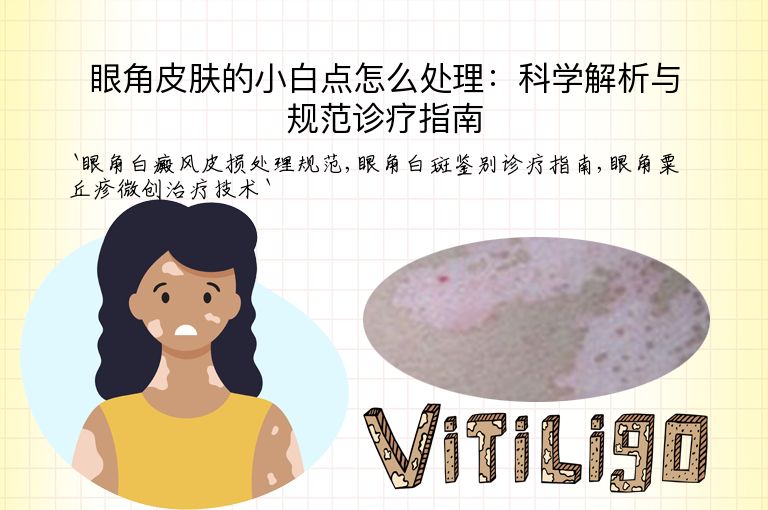 眼角皮肤的小白点怎么处理:科学解析与规范诊疗指南