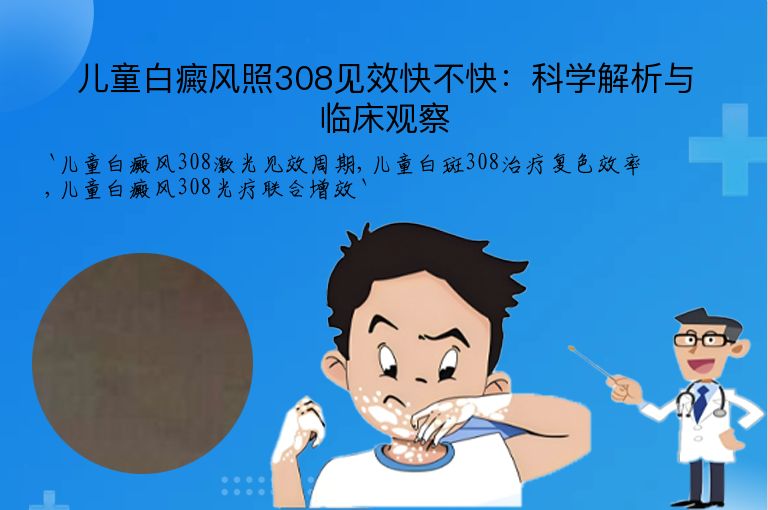 儿童白癜风照308见效快不快:科学解析与临床观察