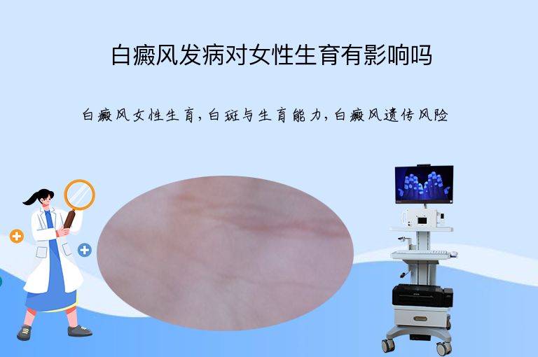 白癜风发病对女性生育有影响吗”