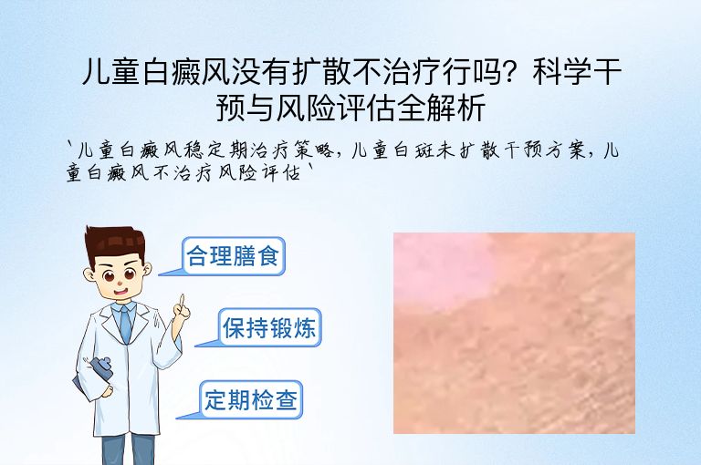 儿童白癜风没有扩散不治疗行吗?科学干预与风险评估全解析