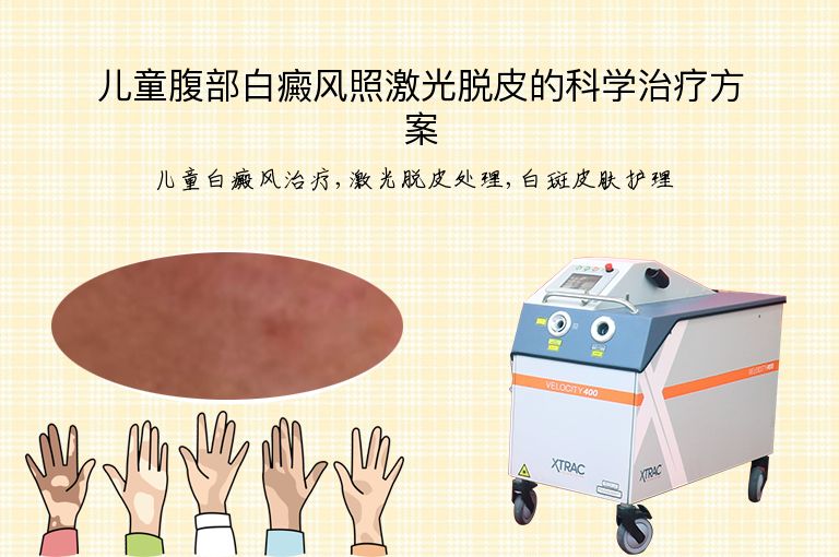 儿童腹部白癜风照激光脱皮的科学治疗方案”