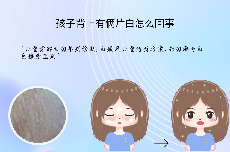 孩子背上有俩片白怎么回事