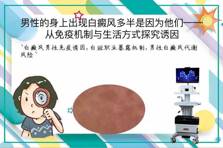 男性的身上出现白癜风多半是因为他们——从免疫机制与生活方式探究诱因