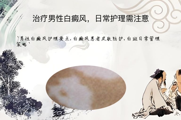 治疗男性白癜风，日常护理需注意