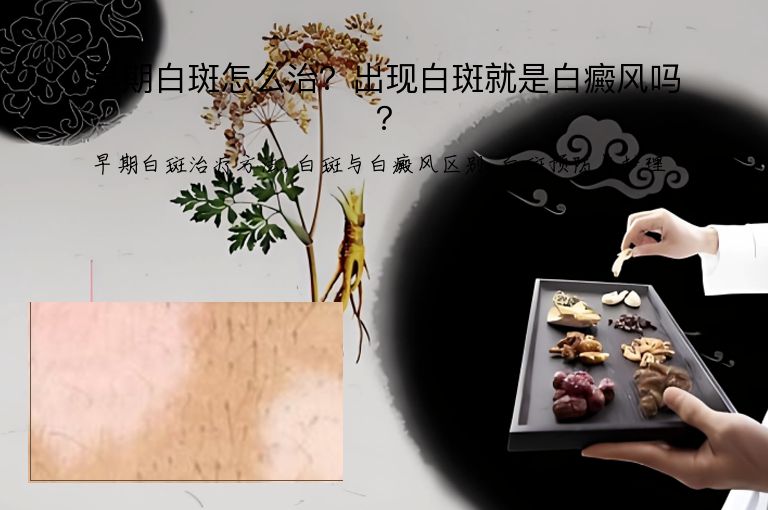 早期白斑怎么治?出现白斑就是白癜风吗?”