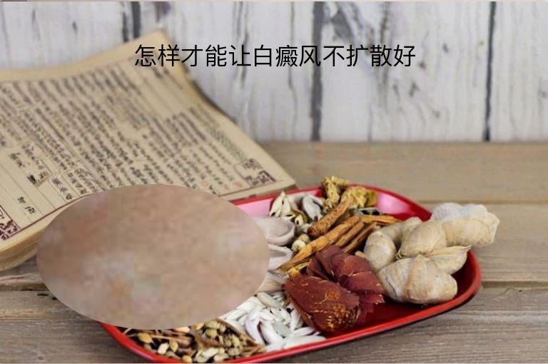 https://www.bdfsjzyy.com/d/file/p/f48bf1515a76decd08af84bc88279dcb.jpeg