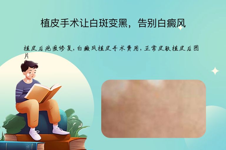 https://www.bdfsjzyy.com/d/file/p/106209a6d64b3476339c0fb52c6e2803.jpeg