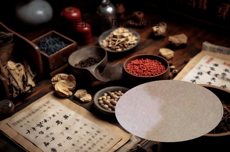手上白癜风能治好吗