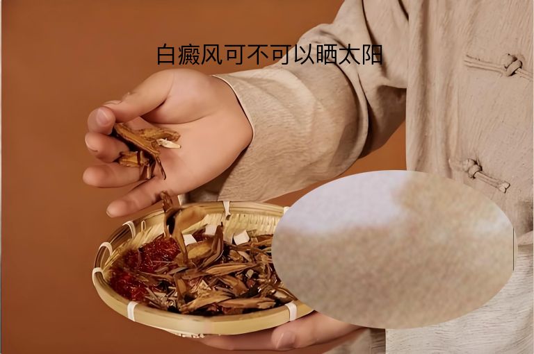 白癜风可不可以晒太阳”