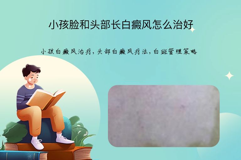 小孩脸和头部长白癜风怎么治好”