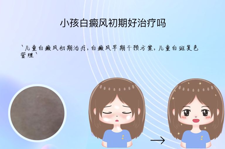 小孩白癜风初期好治疗吗