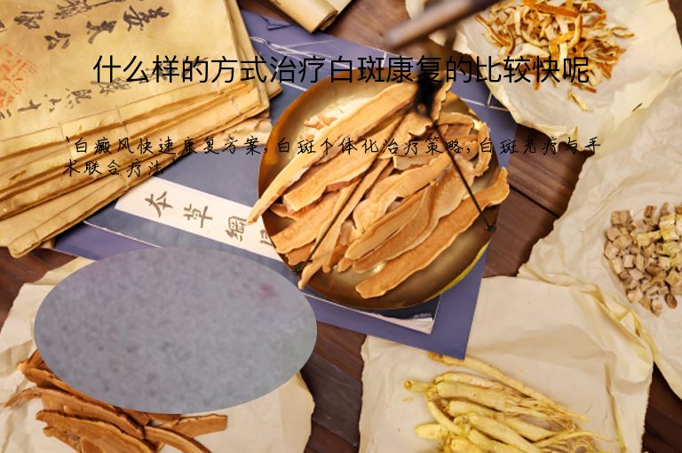 什么样的方式治疗白斑康复的比较快呢