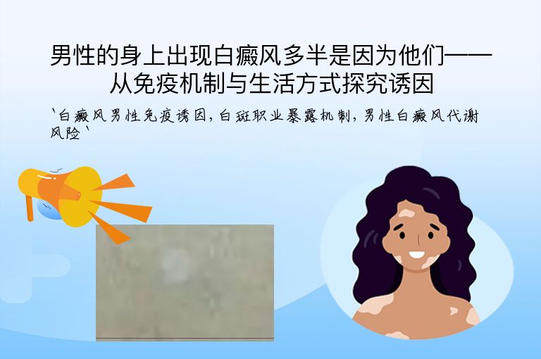 男性的身上出现白癜风多半是因为他们——从免疫机制与生活方式探究诱因