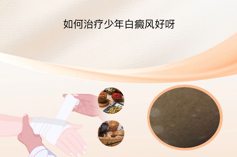如何治疗少年白癜风好呀”
