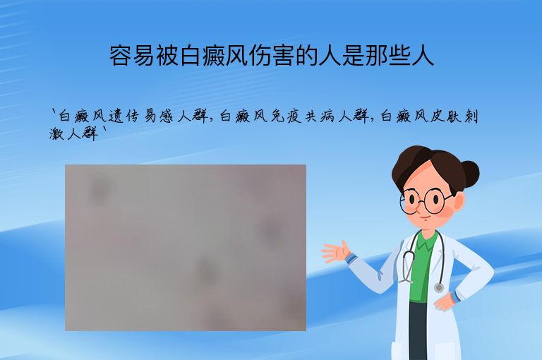 容易被白癜风伤害的人是那些人”