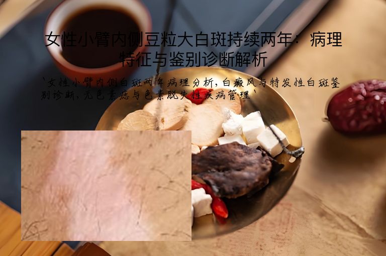女性小臂内侧豆粒大白斑持续两年：病理特征与鉴别诊断解析”