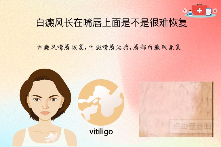 https://www.bdfsjzyy.com/d/file/p/574cec1d39777f39c3159b50779ca3d8.jpeg