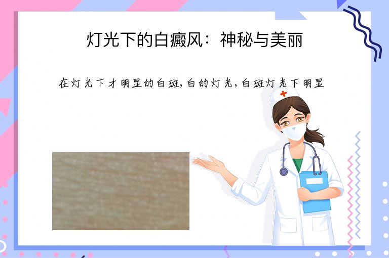 灯光下的白癜风：神秘与美丽”