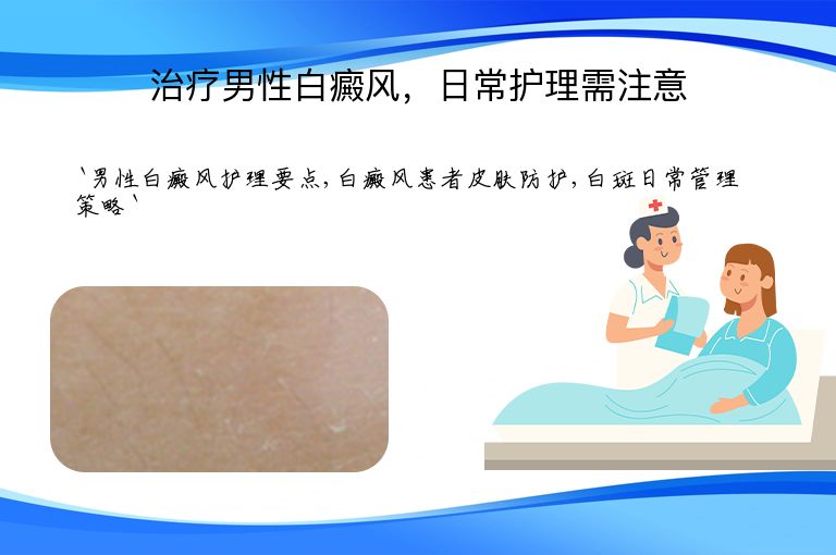 治疗男性白癜风,日常护理需注意
