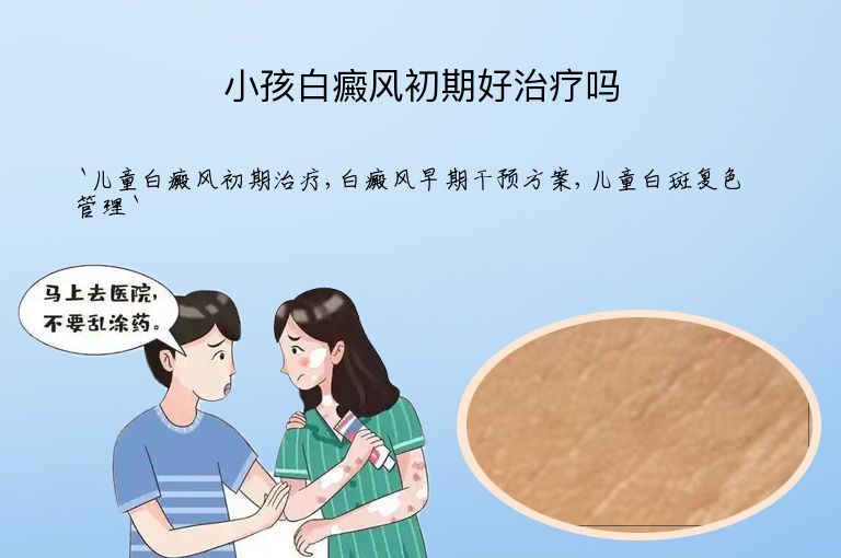 小孩白癜风初期好治疗吗