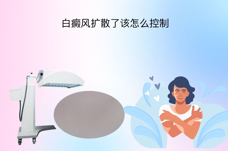 白癜风扩散了该怎么控制”