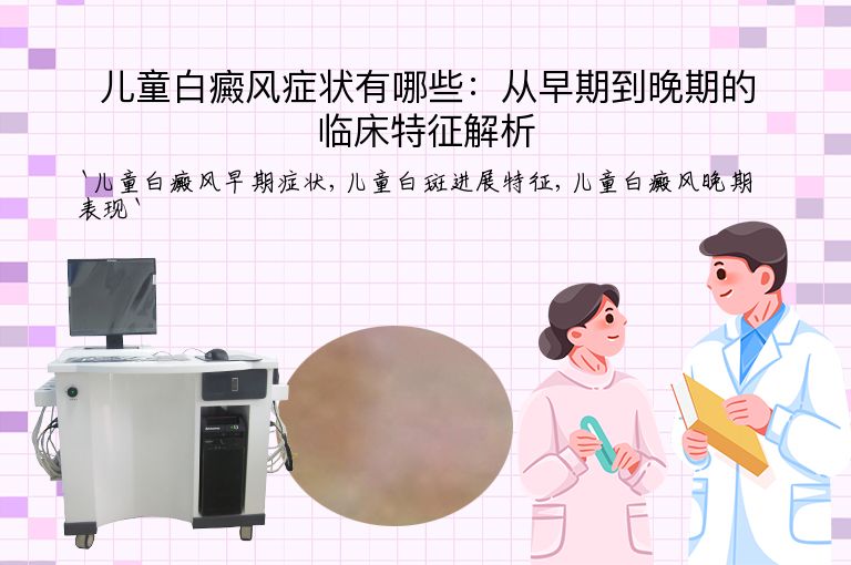 儿童白癜风症状有哪些:从早期到晚期的临床特征解析