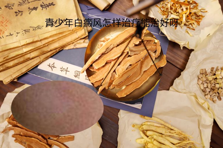 青少年白癜风怎样治疗能治好呀”