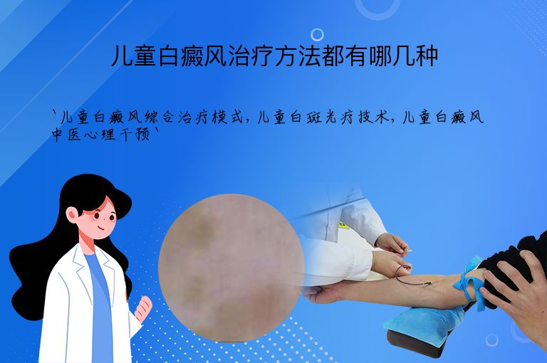 儿童白癜风治疗方法都有哪几种”
