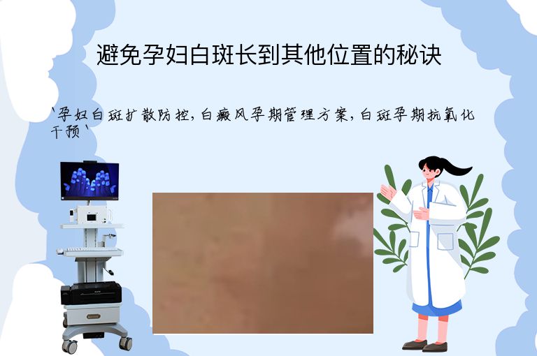 避免孕妇白斑长到其他位置的秘诀