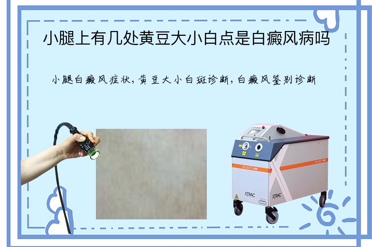 https://www.bdfsjzyy.com/d/file/p/150e141416da0ba28a8e78c863845a10.jpeg