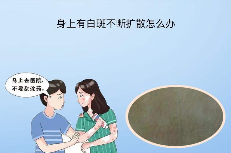 https://www.bdfsjzyy.com/d/file/p/983f12de4a14ca7b005f5fdc7aec59d1.jpeg