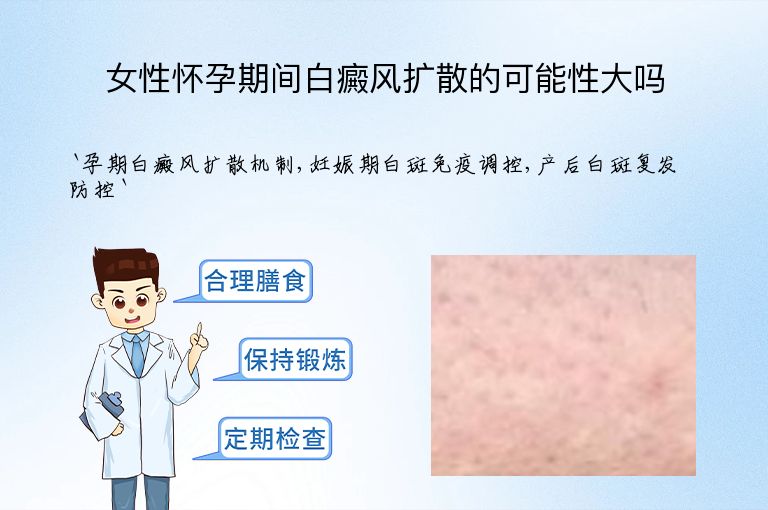 女性怀孕期间白癜风扩散的可能性大吗”