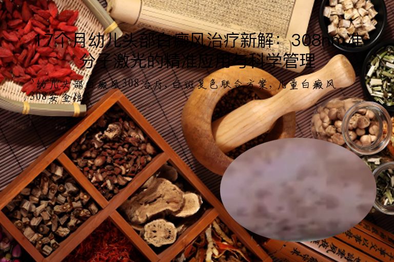 17个月幼儿头部白癜风治疗新解：308nm准分子激光的精准应用与科学管理”