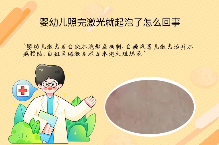 婴幼儿照完激光就起泡了怎么回事”