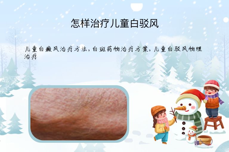 怎样治疗儿童白驳风”