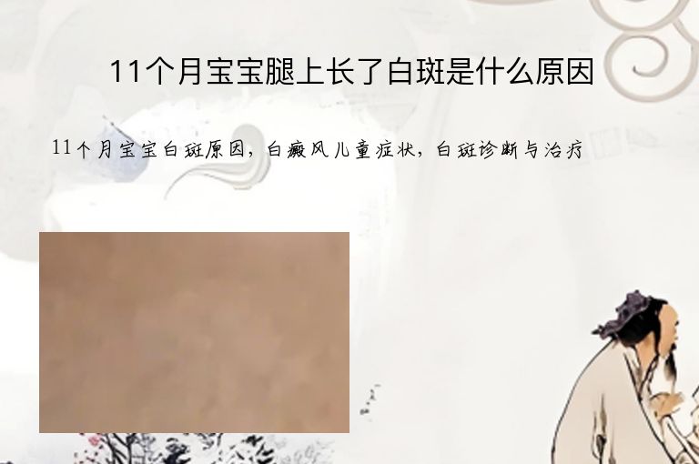 https://www.bdfsjzyy.com/d/file/p/30cbee51e880fcfe69f9ad97def6eab5.jpeg