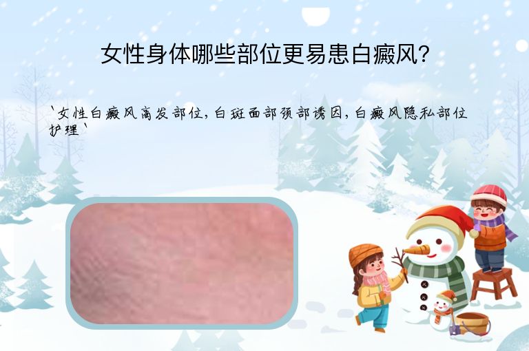 女性身体哪些部位更易患白癜风？”