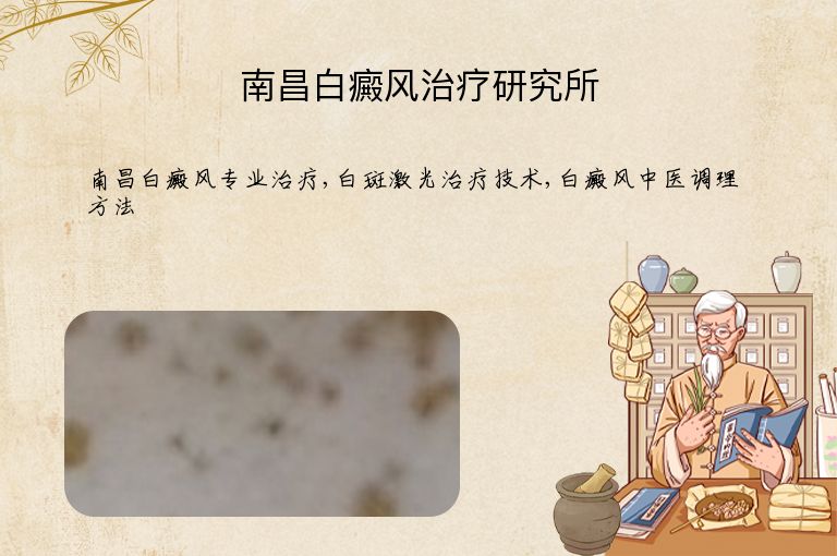 南昌白癜风治疗研究所”