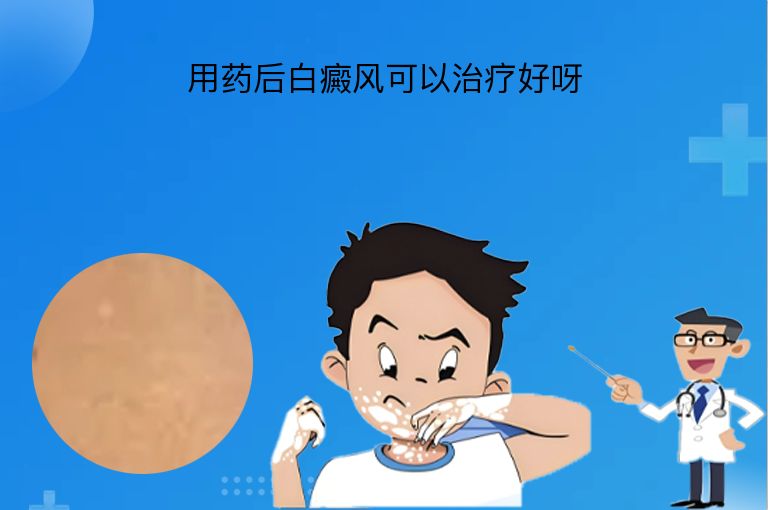 https://www.bdfsjzyy.com/d/file/p/a5afe6635731dd5b3da1f497594d1d47.jpeg