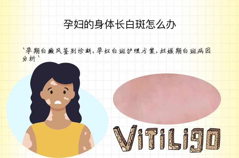 孕妇的身体长白斑怎么办”