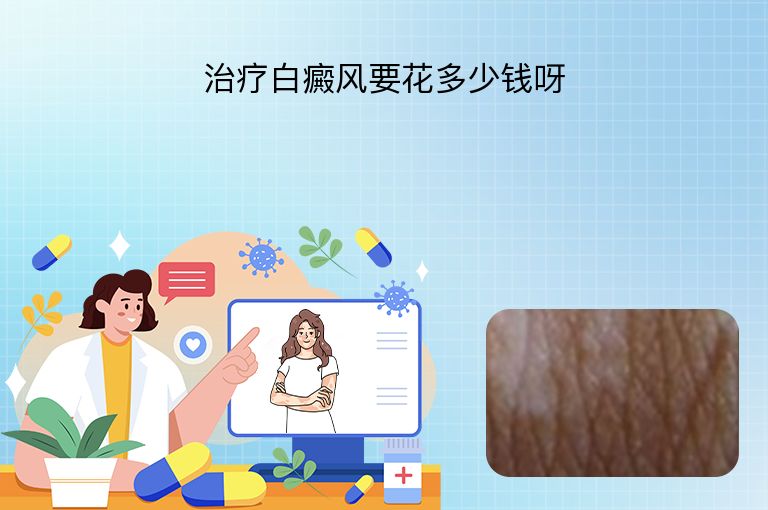 治疗白癜风要花多少钱呀”