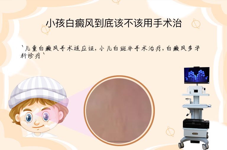 小孩白癜风到底该不该用手术治”