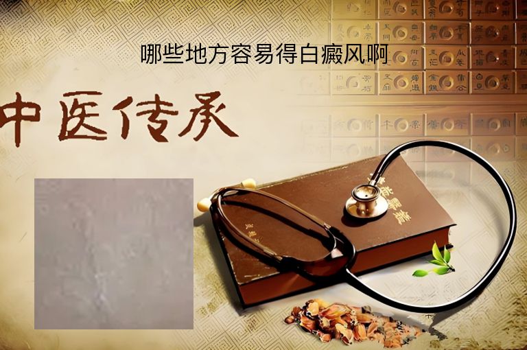 哪些地方容易得白癜风啊”