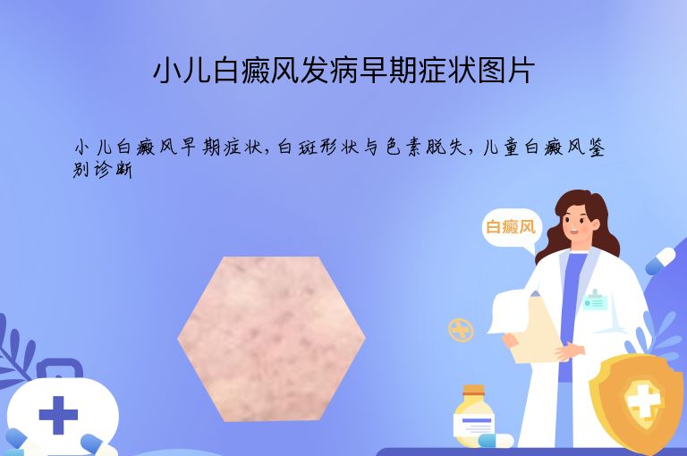https://www.bdfsjzyy.com/d/file/p/b4729f705496f99dceb4b4f4852542e8.jpeg